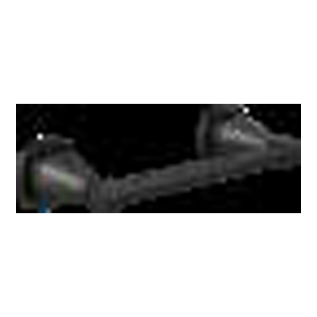 Stryke Tissue Holder